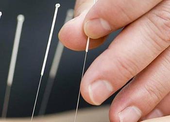 UB Acupuncture MS student using needles